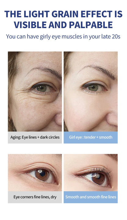 ELICTRIC MASSAGE EYE CREAM