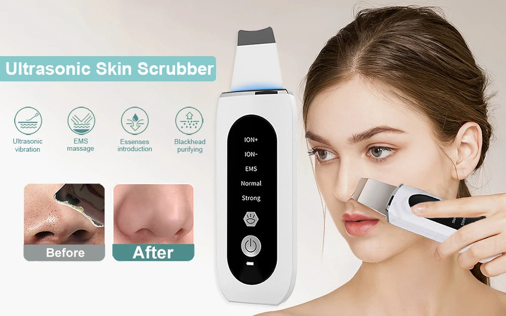 ULTRASONIC SKIN SCRUBBER