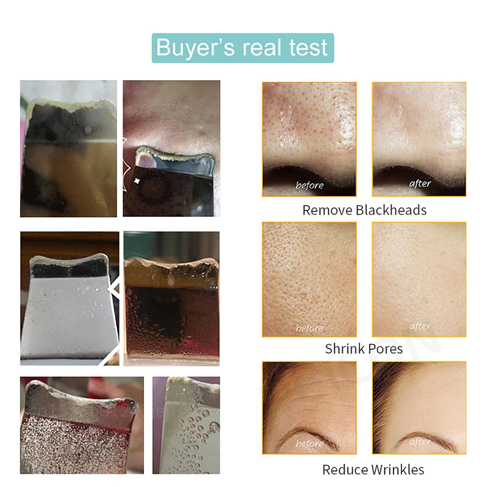 ULTRASONIC SKIN SCRUBBER