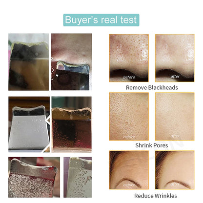 ULTRASONIC SKIN SCRUBBER