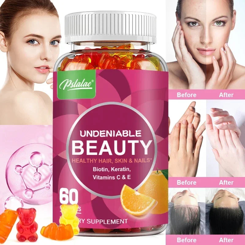 GUMMIES